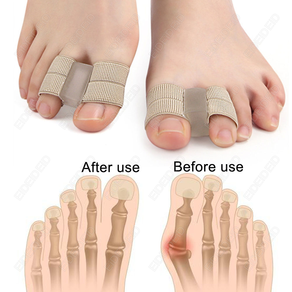 Bunion toe Corrector Orthotics – Women'S Shoes With Bunions Bewertung und Preis
